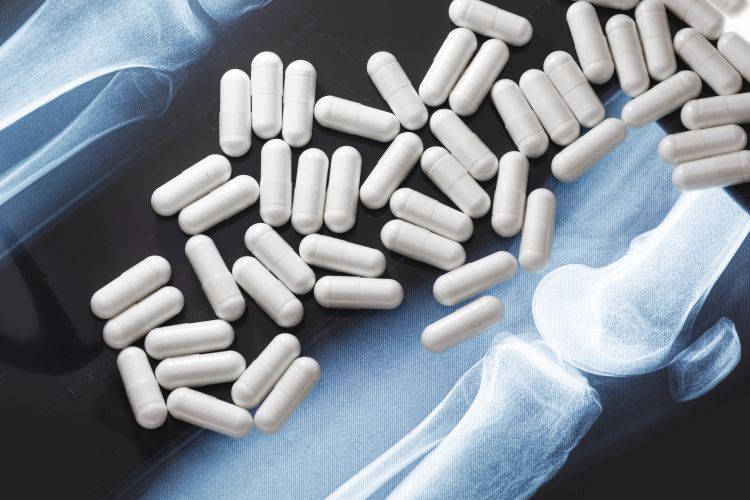 Joint Pain Supplements for Runners